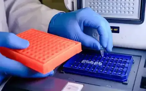 TNF Alpha ELISA Kit Overview for Cytokine Detection and Laboratory Analysis Basics